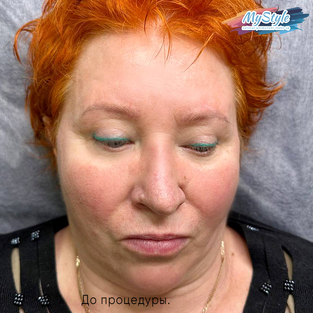 До процедуры.