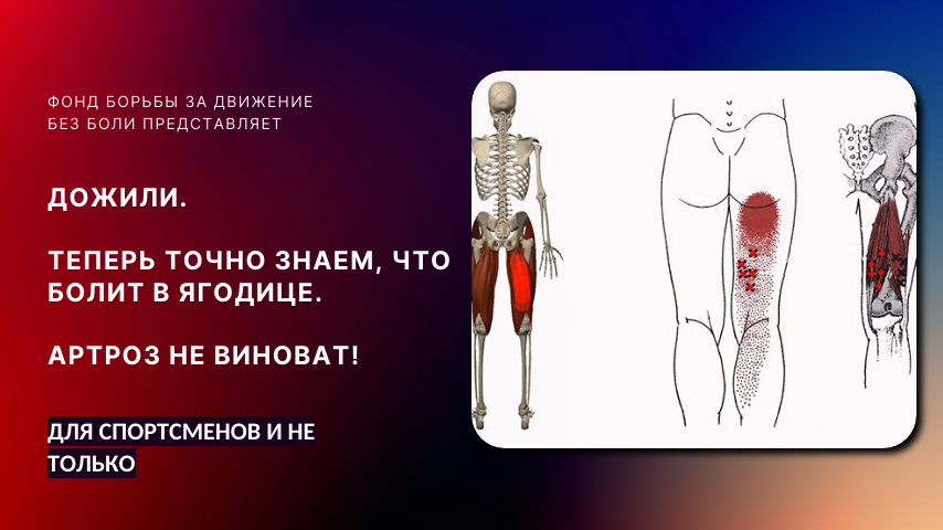 Глубокая боль в ягодице.