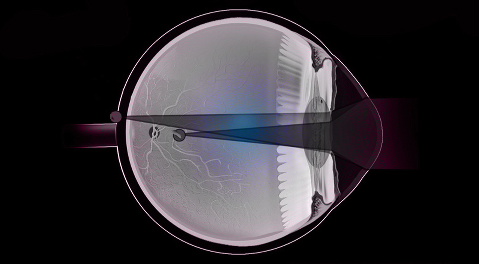   N + 1; BruceBlaus / Wikimedia Commons / CC-BY-SA-4.0