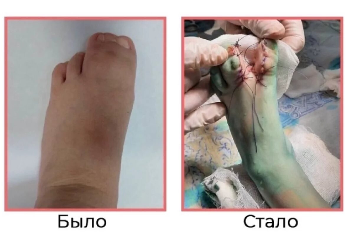    Трудно ходить.