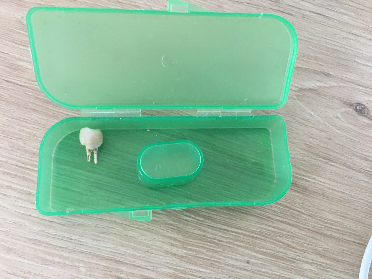 На всякий случай не стала выбрасывать. Вымыла и положила в контейнер для зубочистки. 