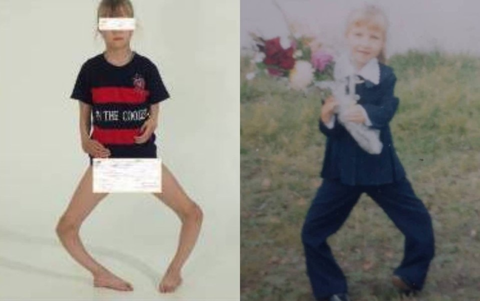 Фото: из личного архива героини публикации, НМИЦ ТО им. акад. Г.А. Илизарова. Опубликовано «КП-Иркутск»