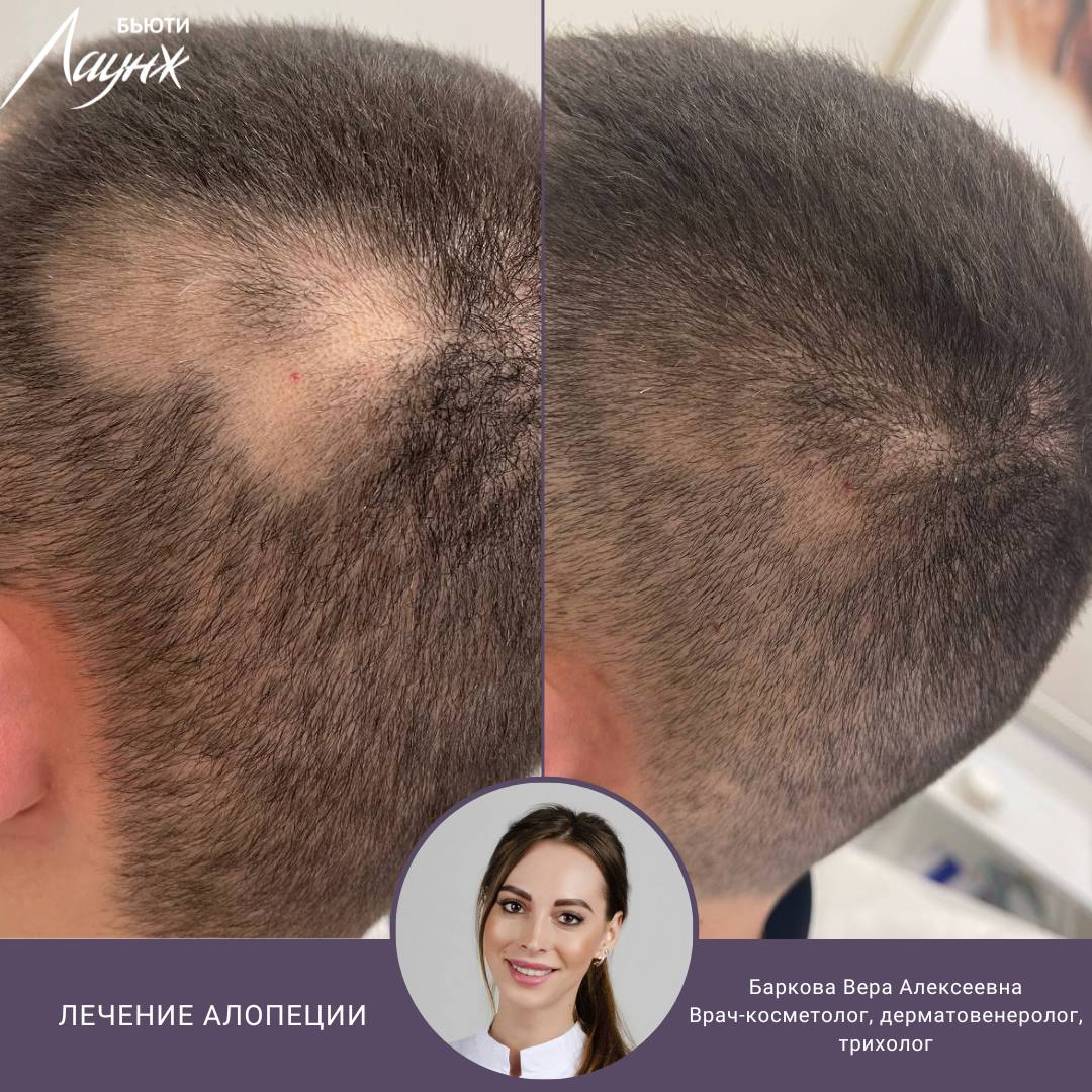 ИМЕЮТСЯ ПРОТИВОПОКАЗАНИЯ, НЕОБХОДИМА КОНСУЛЬТАЦИЯ СПЕЦИАЛИСТА