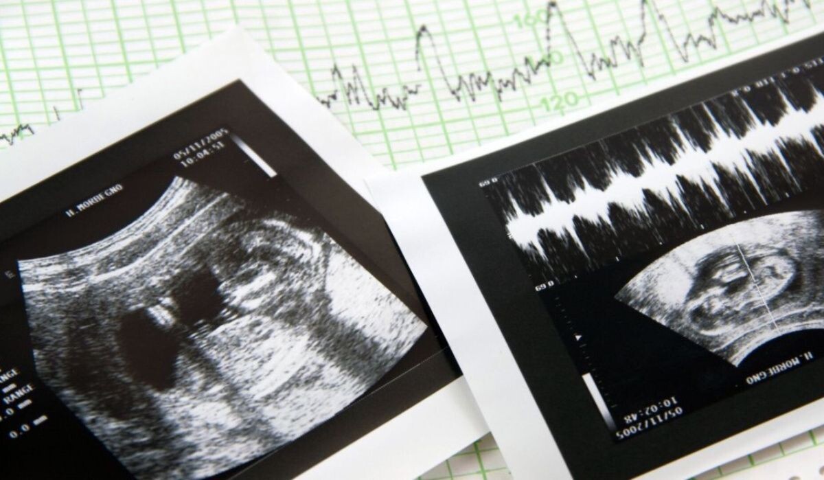     Результаты эхографии. Источник: fotolia.com Автор фото: wlablack