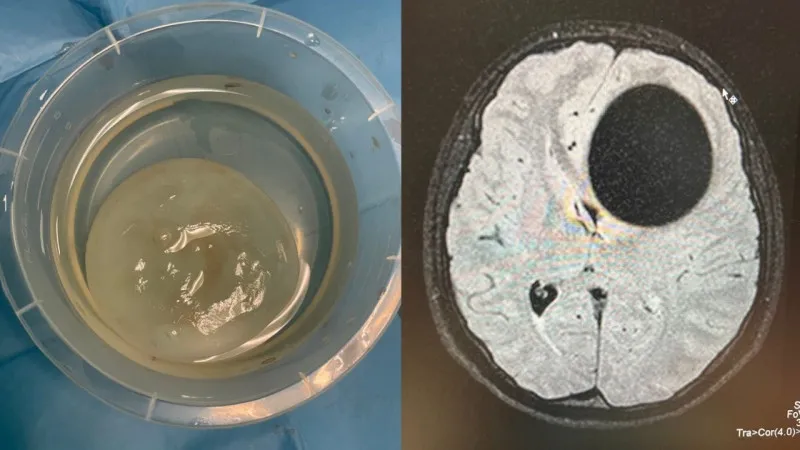 Да, на рентгене мозг человека, а в баночке то что оттуда достали. И это не мозговой слизень управления зоозащитниками. Хотя кто знает)))