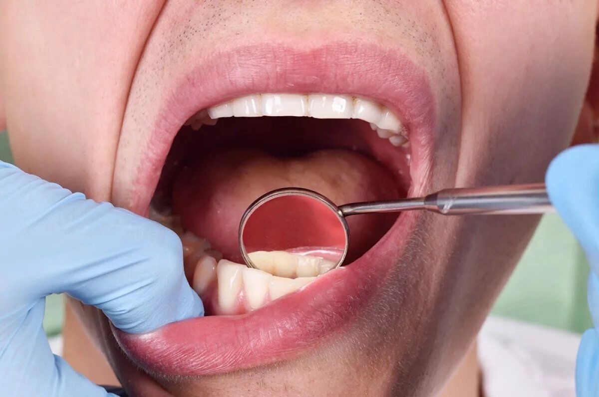    Кальций и фтор.