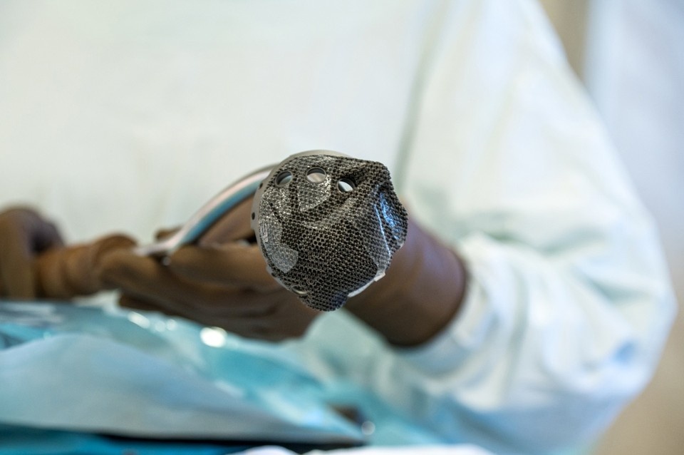    Новый протез позволит устранить инфекцию. Фото: СамГМУ