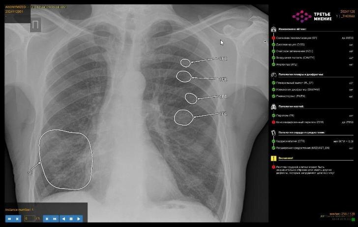    Фото: telegram-канал Айрата Рахматуллина