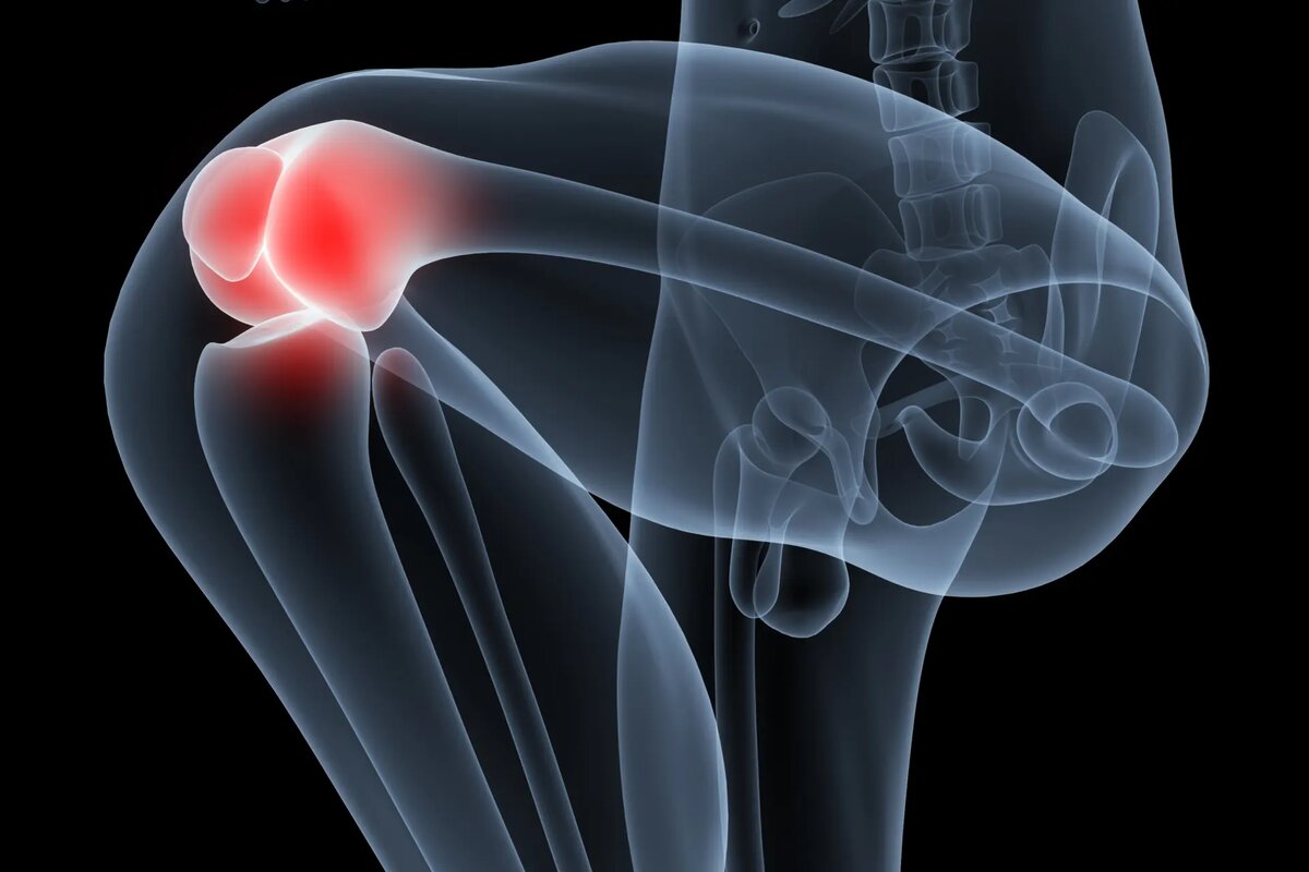 Здоровье – это выбор @zdorovieetovibor – Последствия хронического воспаления для здоровья