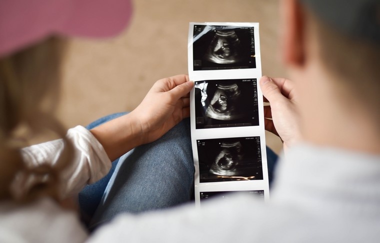    Shutterstock/FOTODOM