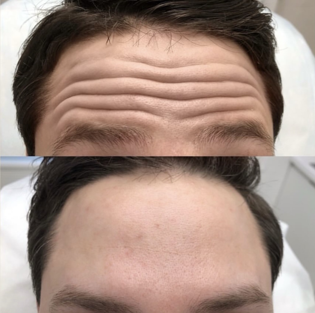 Источник: cosmetologmoscow.ru