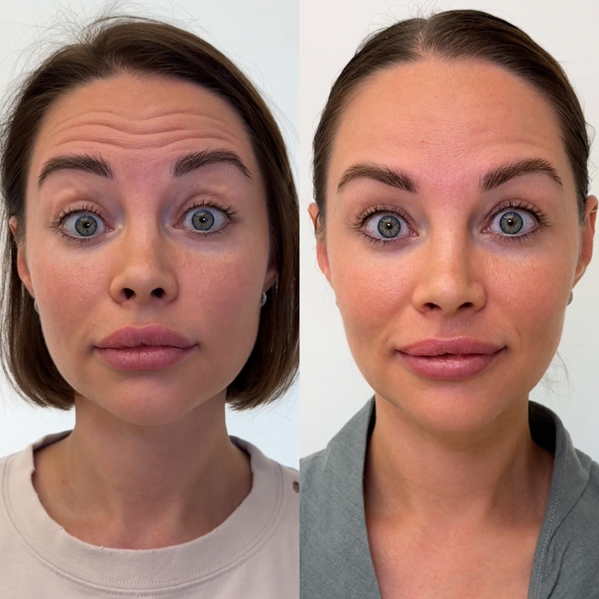 Источник: cosmetologmoscow.ru