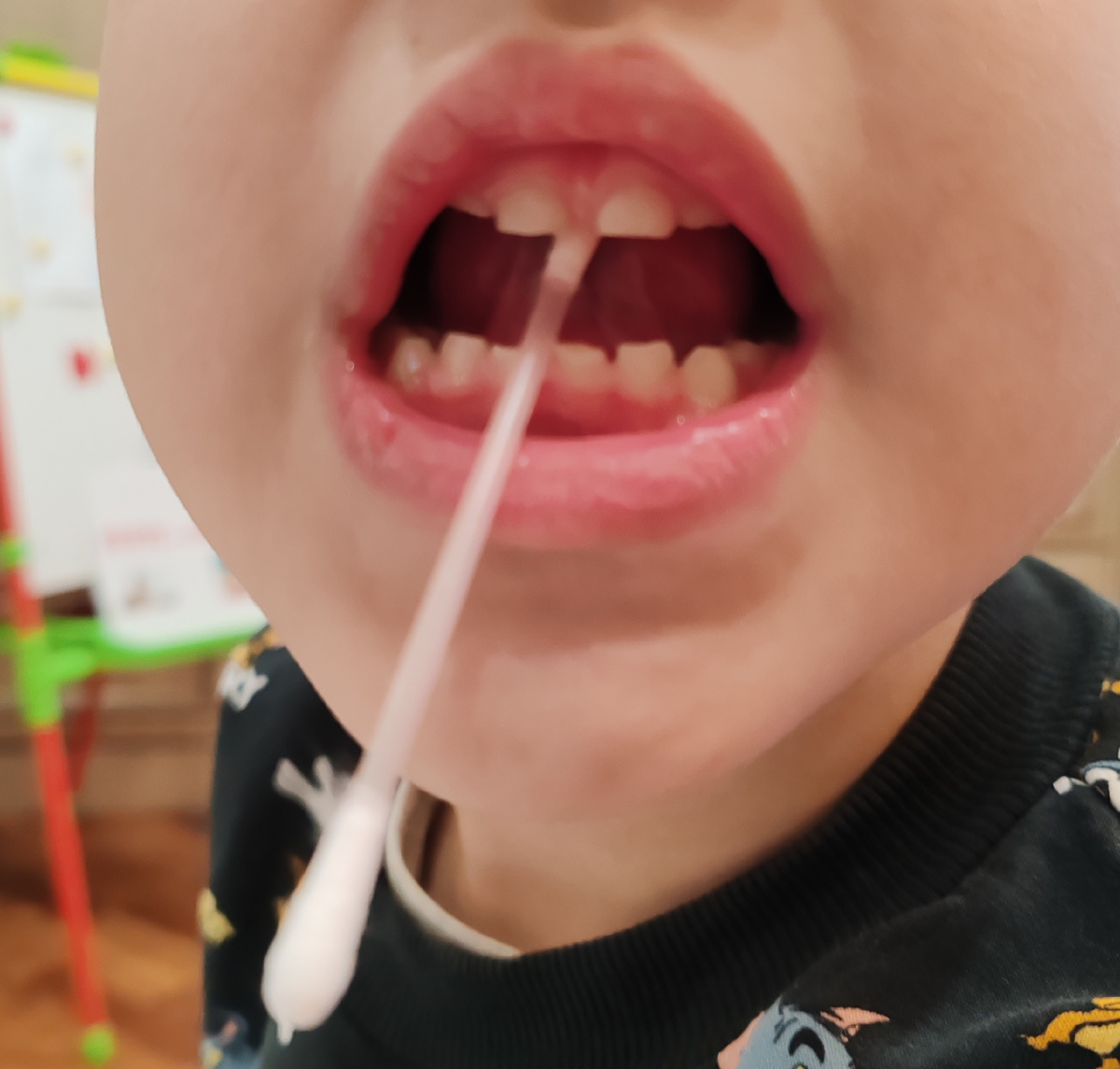 Укрепляем кончик языка. 👍👍👍