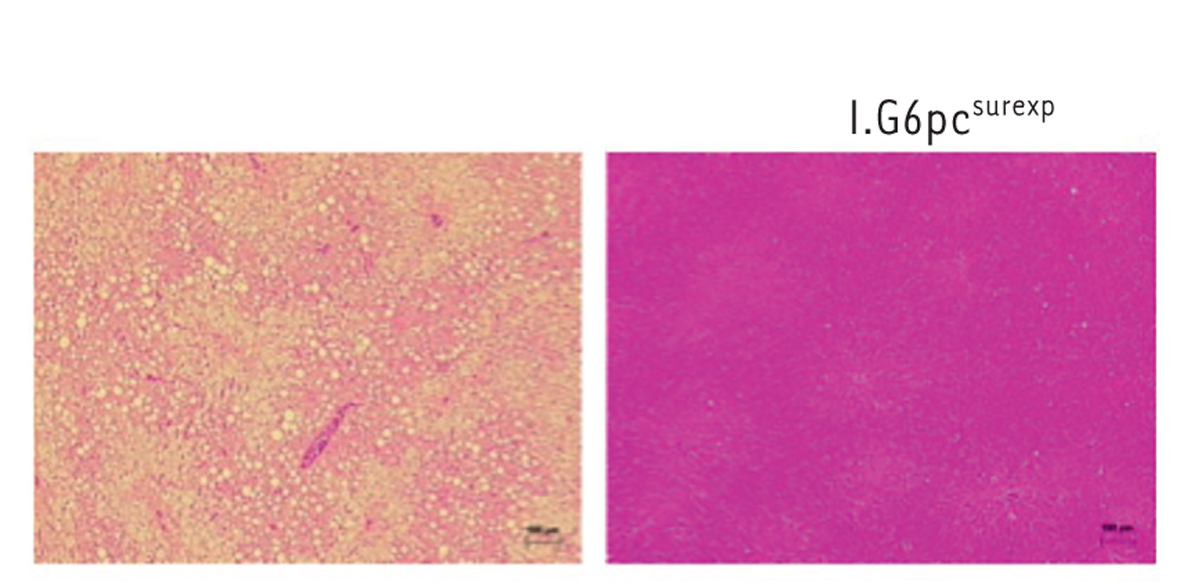 Гистологические срезы печени, окрашенные гематоксилином, мышей, которых в течение 5 месяцев кормили высококалорийной диетой. Печень контрольных мышей (слева) содержит многочисленные липидные капли, отражающие начало жировой болезни печени. Напротив, при активации кишечного глюконеогенеза (справа) липидная нагрузка печени очень низкая. Благодаря конститутивной экспрессии I.G6PC мыши защищены от жировой болезни печени [1].