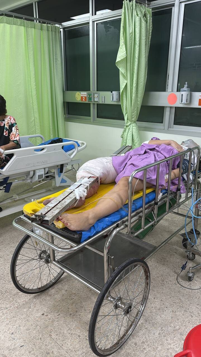 Аллюминиевая балка сечением 15х20 см - часть грузовика - нанизала женскую ногу как на шампур. 
