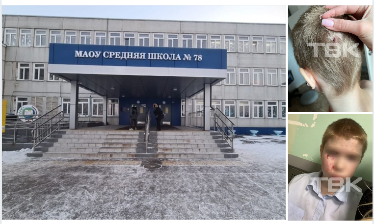 Защитить своего ребёнка и не сесть в тюрьму. Травля в школе, бездействие учителей, проблемы и решения