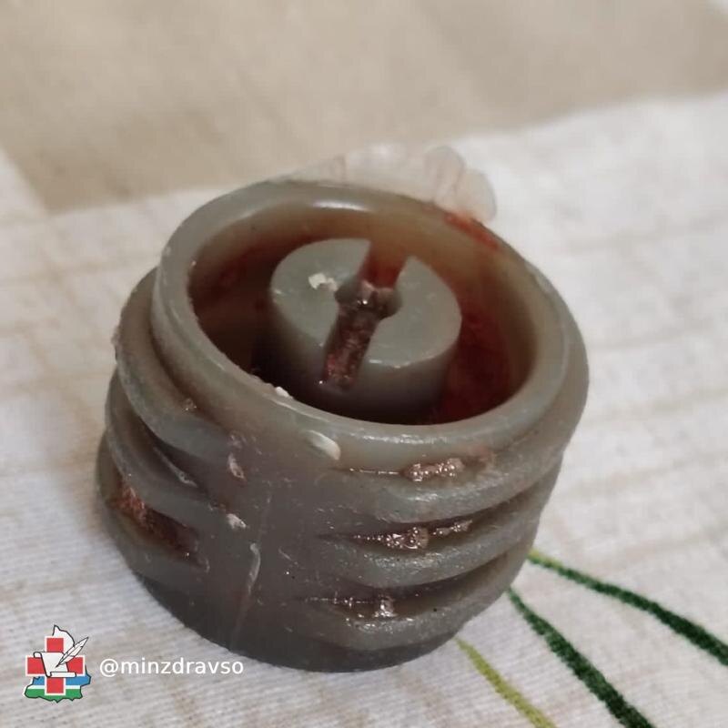    Пресс-служба минздрава Свердловской области/ Шайба, из-за которой едва не погиб ребенок