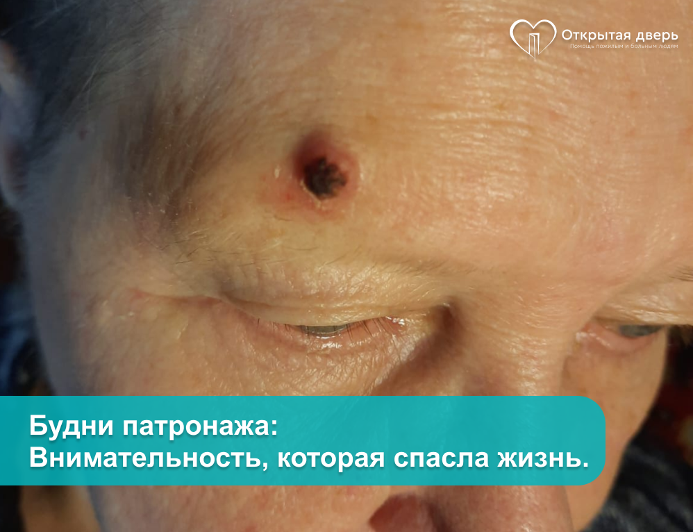 Подопечная патронажной службы "Открытая дверь" 