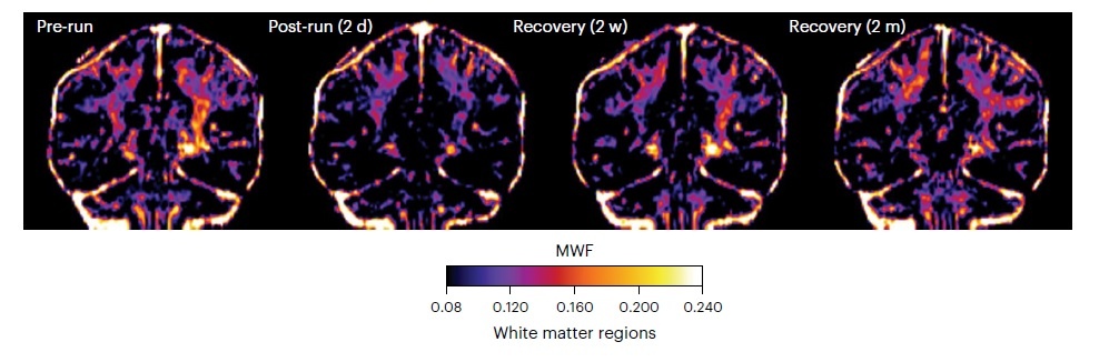   Ramos-Cabrer et al. / Nature Metabolism, 2025