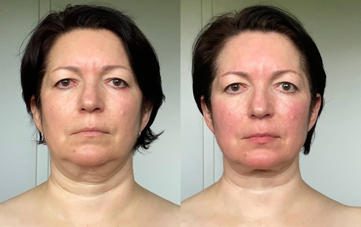 Результаты есть у каждой 