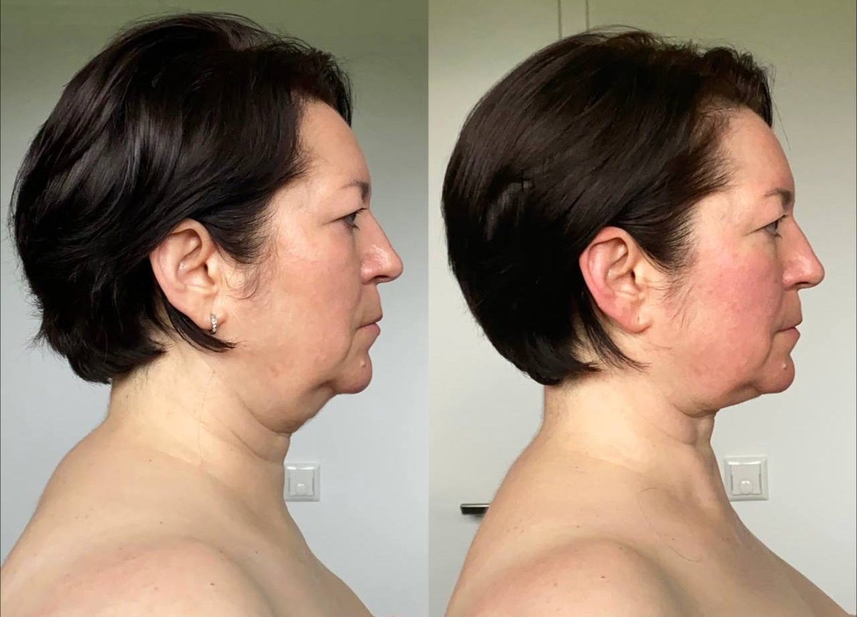 На фото моя ученица - результат спустя 14 дней 