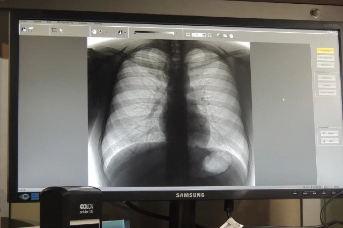    В Майкопе прошла акция «Белая ромашка»