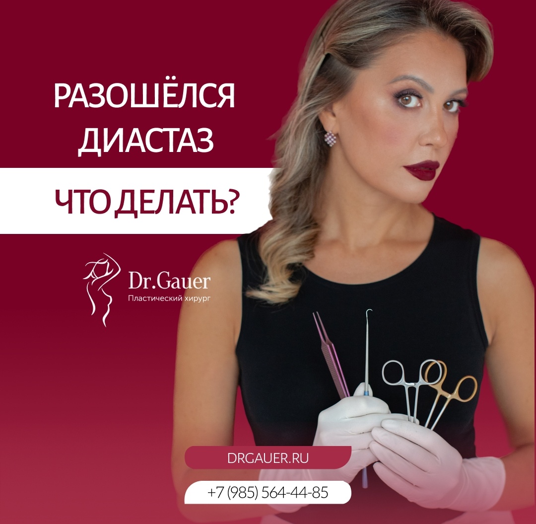 Пластика живота 