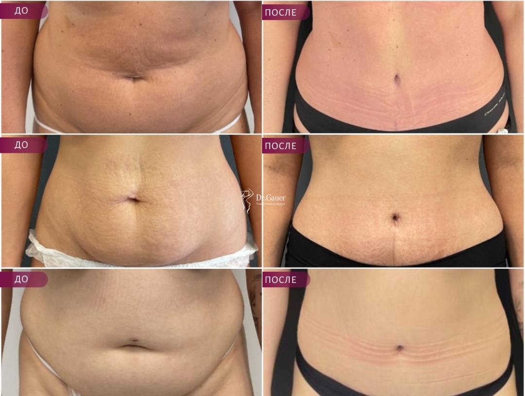 Результаты 