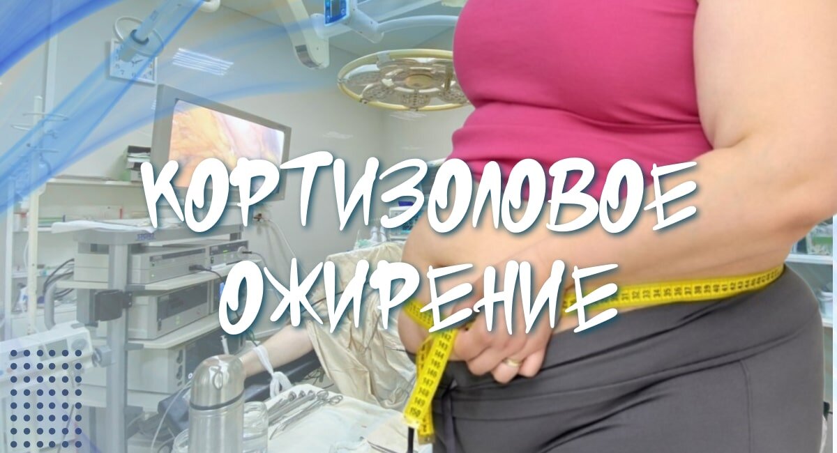 Кортизоловый живот