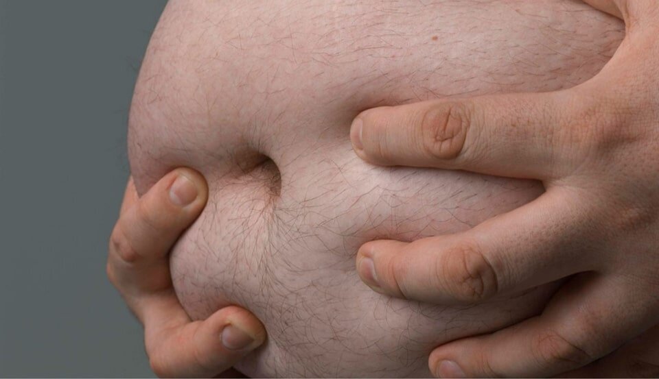 Жировые отложения в области живота