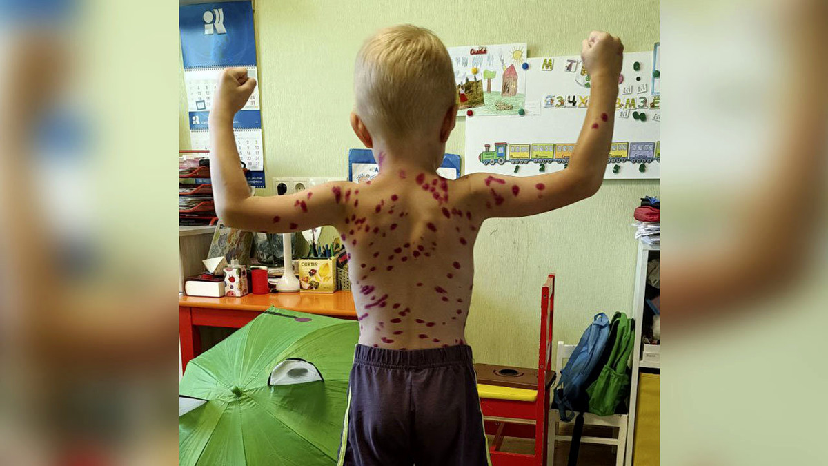 Решение о прививке должно основываться на научных данных и рекомендациях врачей, а не на мифах и страхах. Фото: Олег Машкин