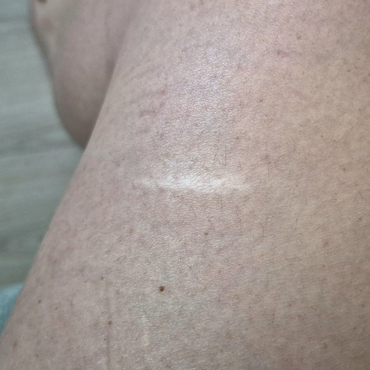 Цвет ноги странный, т.к. пришлось покрутить яркость и контраст
