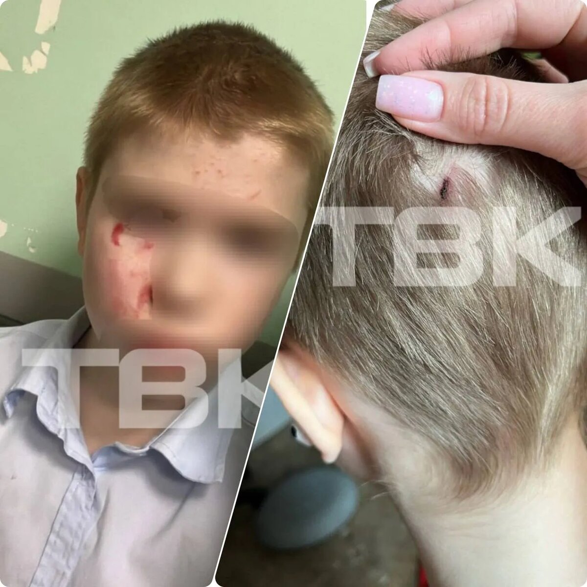    Фото: ТВК. На кадрах избитые мужчиной дети