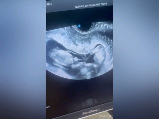     Фото: пресс-служба министерства здравоохранения Воронежской области