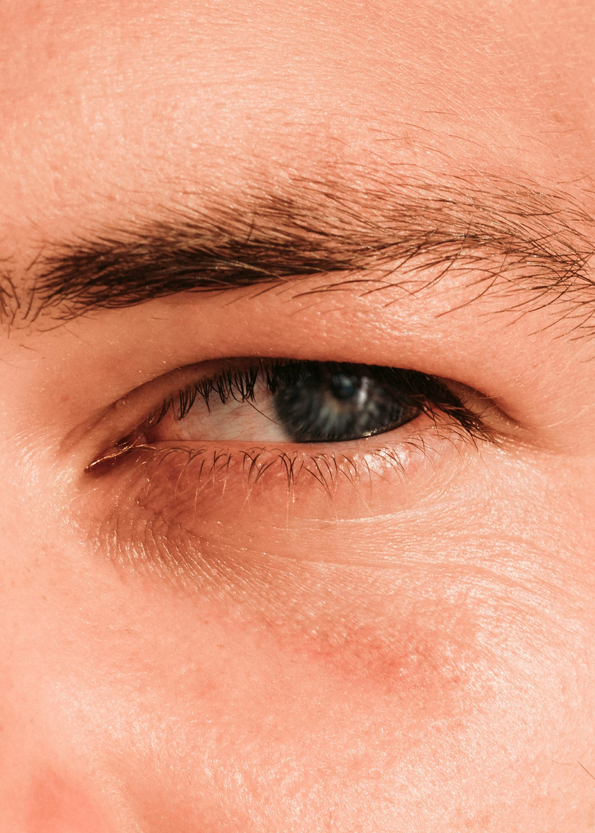 на фото: глаз уже без наращивания