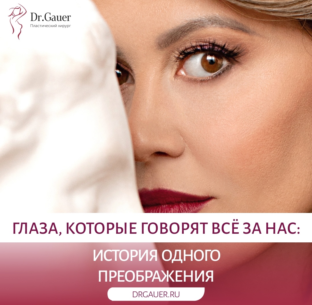 История преображения 