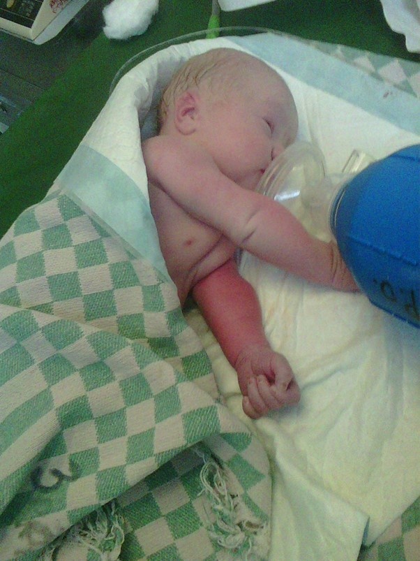 Малыш через несколько минут после рождения