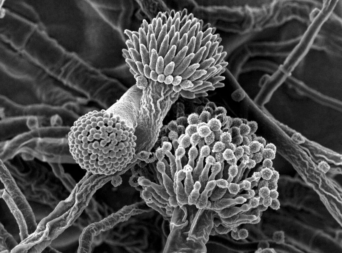 Внешний вид аспергилла под микроскопом 