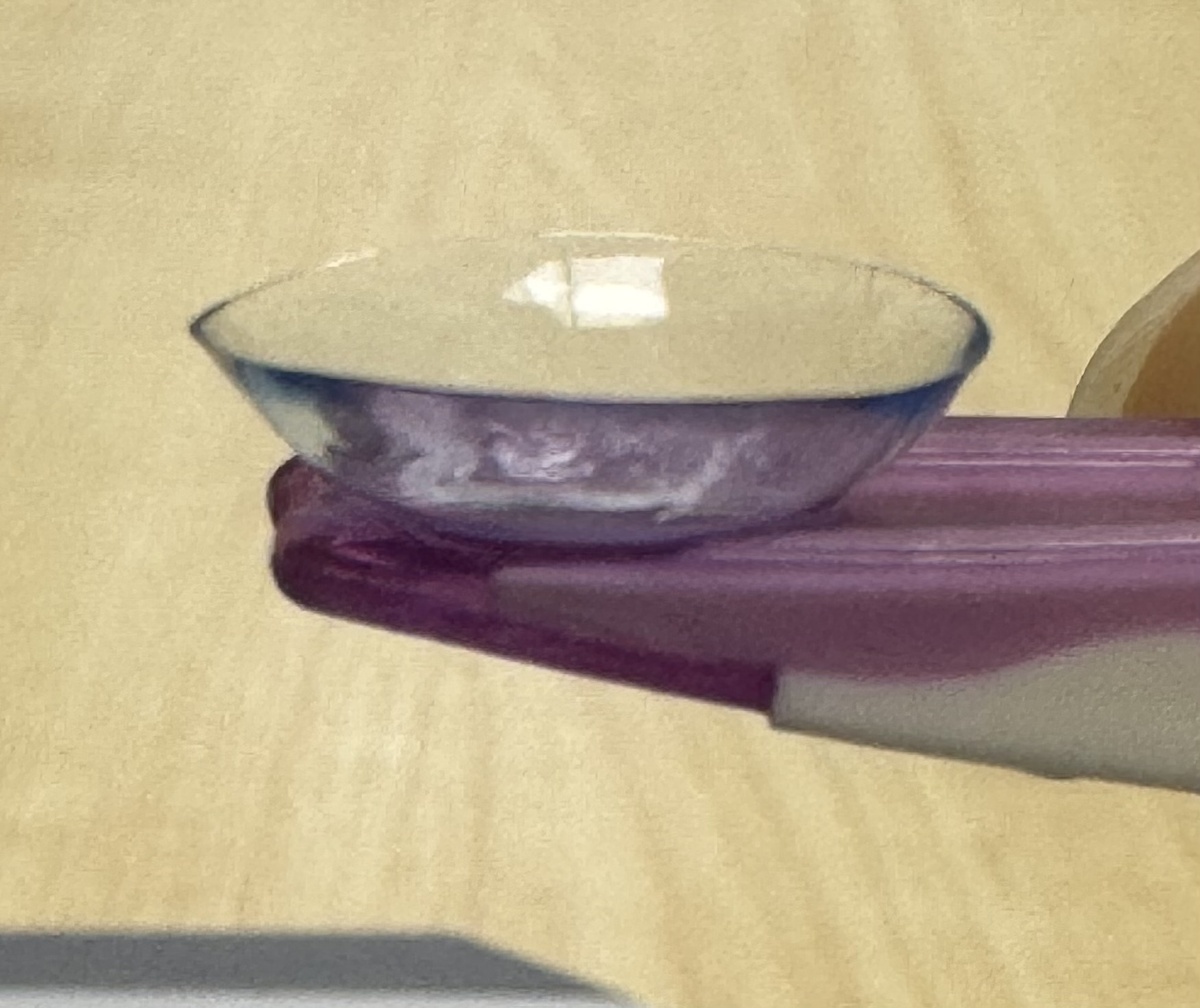 Фото 2. Неправильная ориентация КЛ