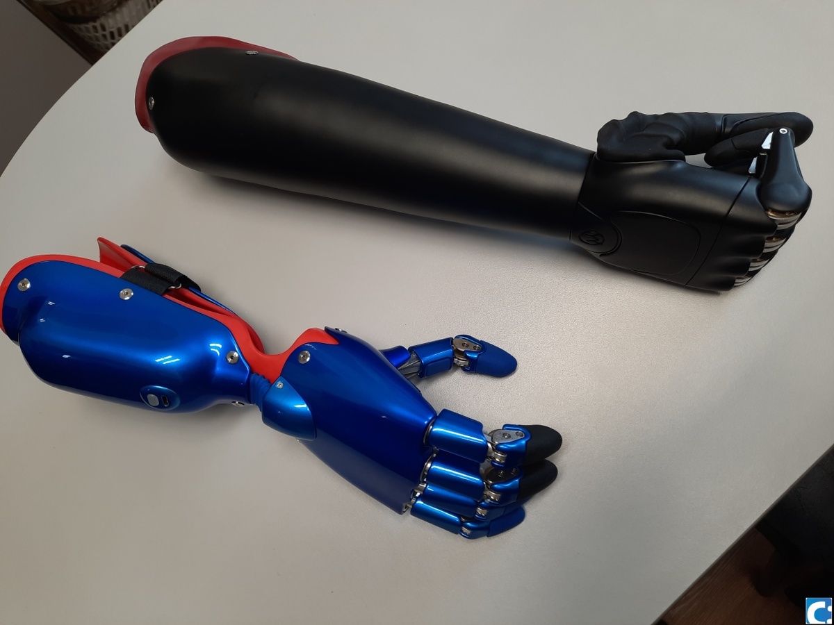    Бионические протезы: как Россия покоряет западные клиники