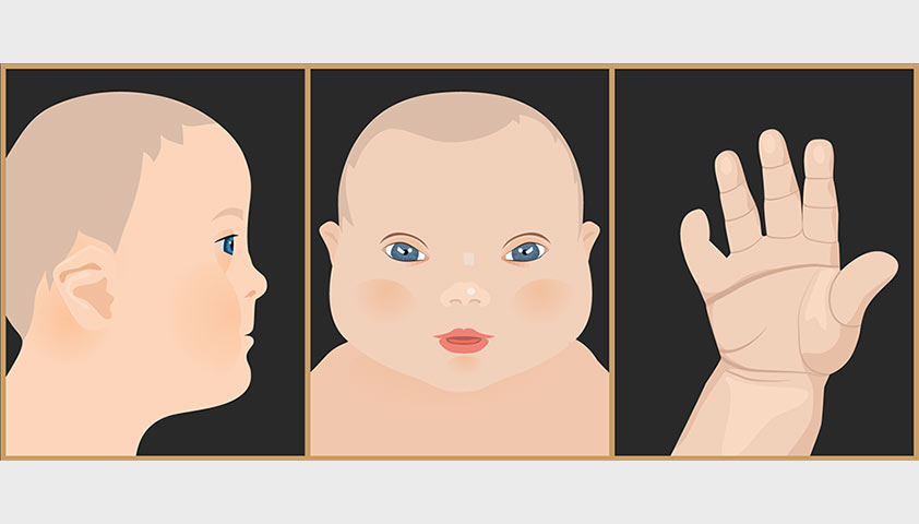 Внешние признаки