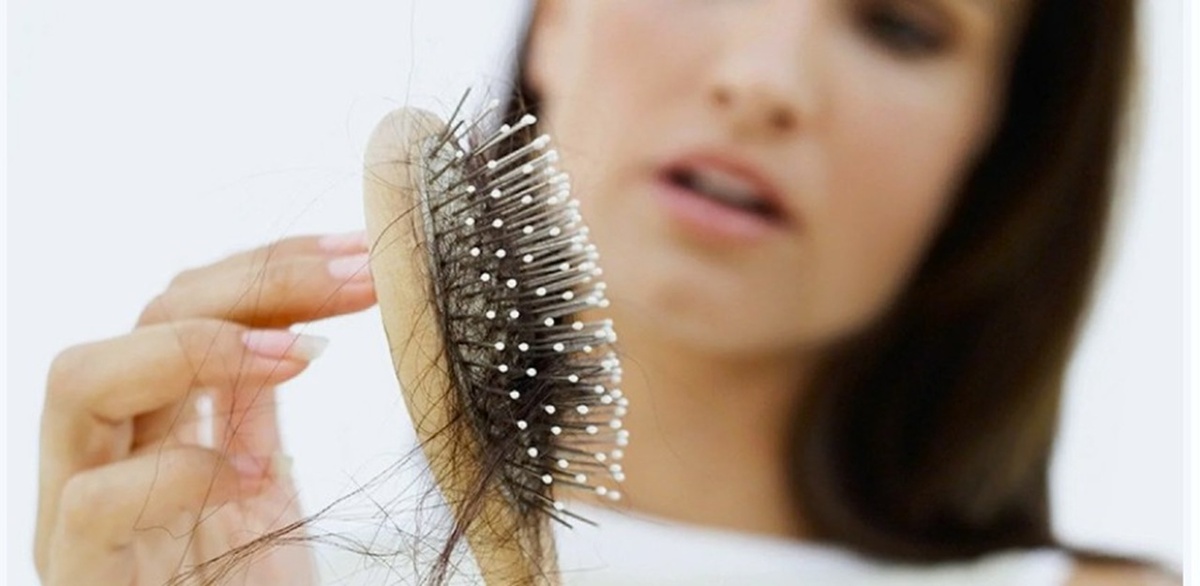 Выпадение волос (Фото Яндекс картинки)