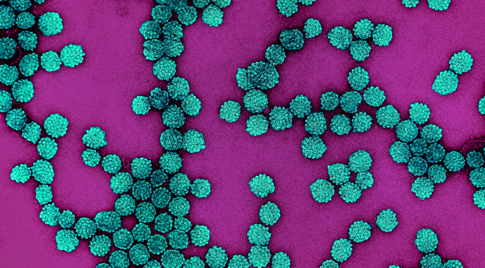   NIAID / Flickr / CC BY 2.0