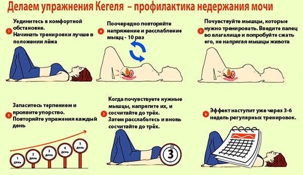 Рис. 1. Упражнения Кегеля для профилактики недержания мочи.