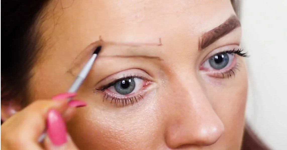 Выпадение бровей: причины, диагностика и лечение