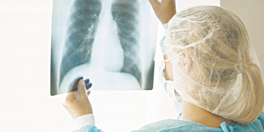 Может быть бессимптомной: в стране продолжается вспышка микоплазменной пневмонии