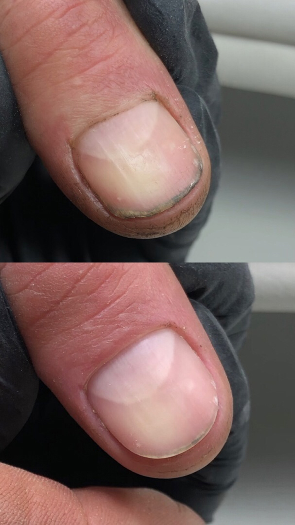 До/после пилочного маникюра 