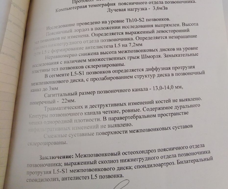 КТ позвоночника