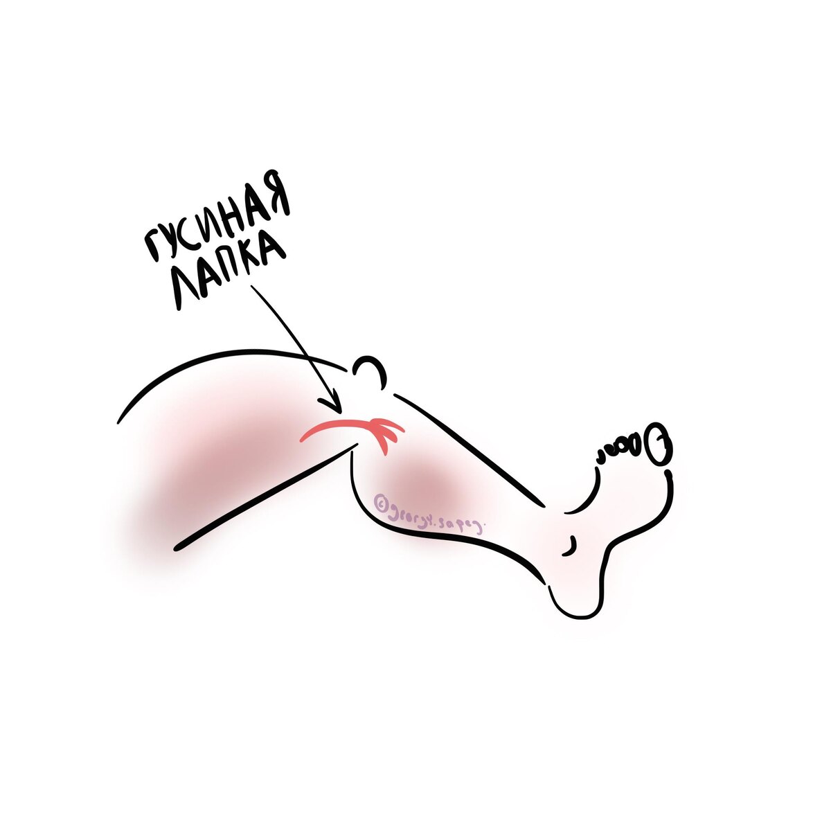 Гусиная лапка