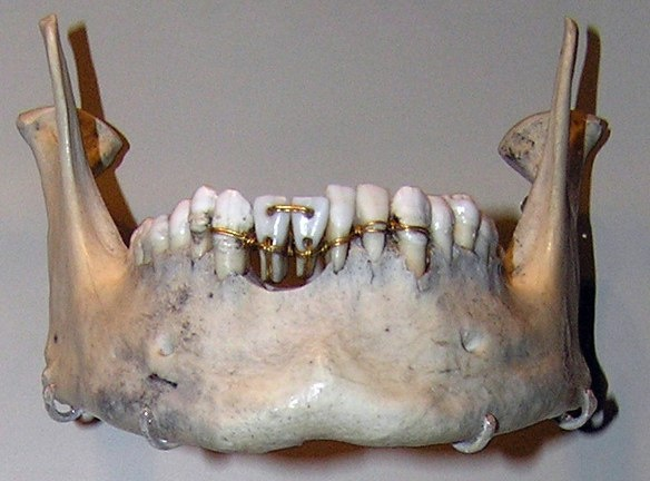 Работа стоматолога из древнего Египта